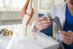 Doctor holds a hip implant next to a knee implant on a table alongside a physiological model of a knee